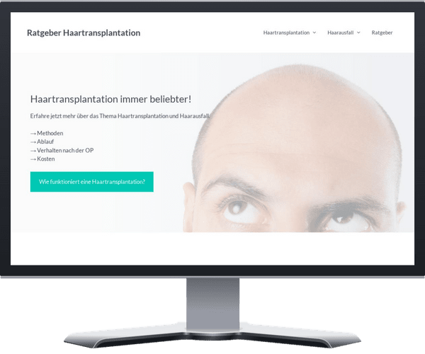 Image of a screenshot from a showcase website - Haartransplantation.